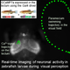 Image for article titled Scientists record the first video of thoughts forming in the brain